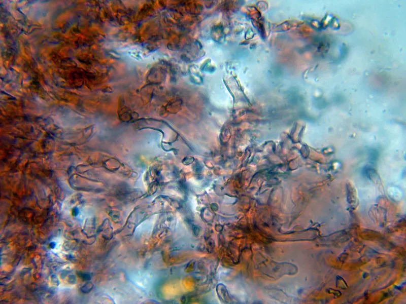 Botryobasidium subcoronatum 12 - Hifas subiculares-002